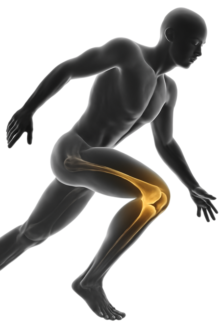 Knee Prosthesis Systems
